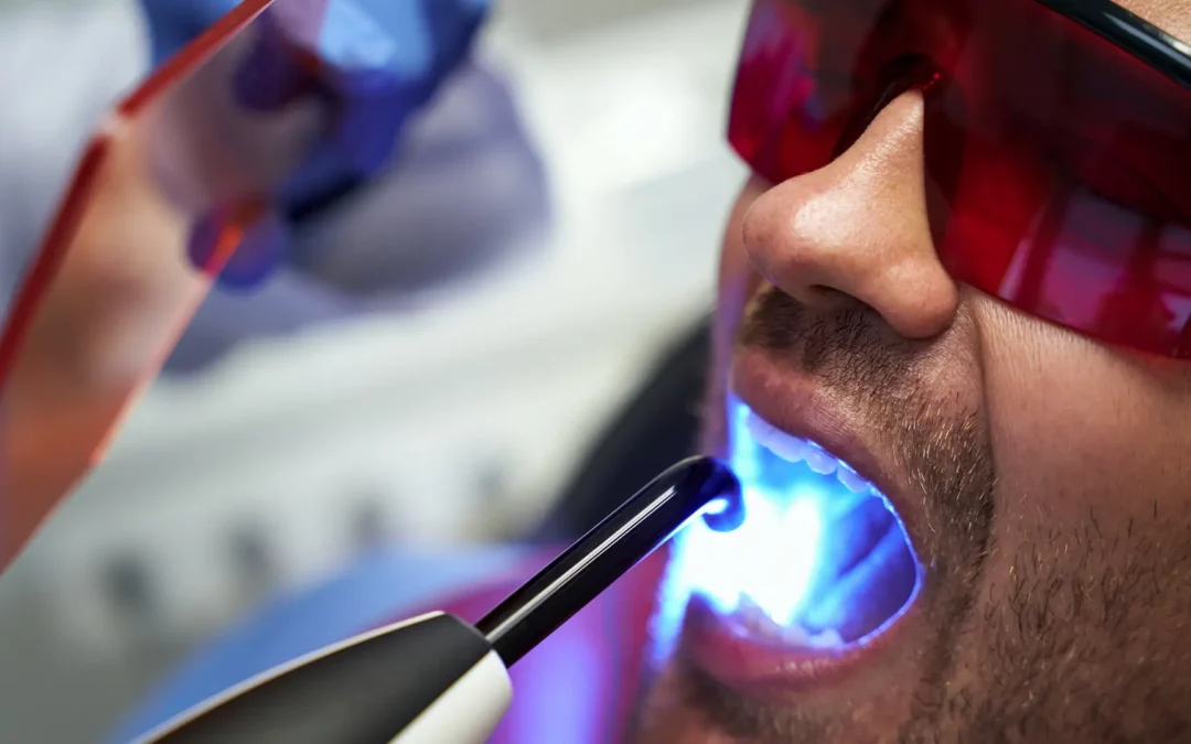 Laser in Odontoiatria