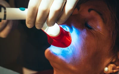 Laser terapia per parodontite a Torino: guarigione rapida e senza bisturi